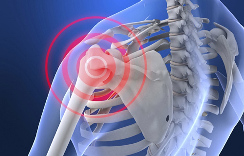 Human skeleton showing back with red pulse effect on shoulder to indicate shoulder pain.